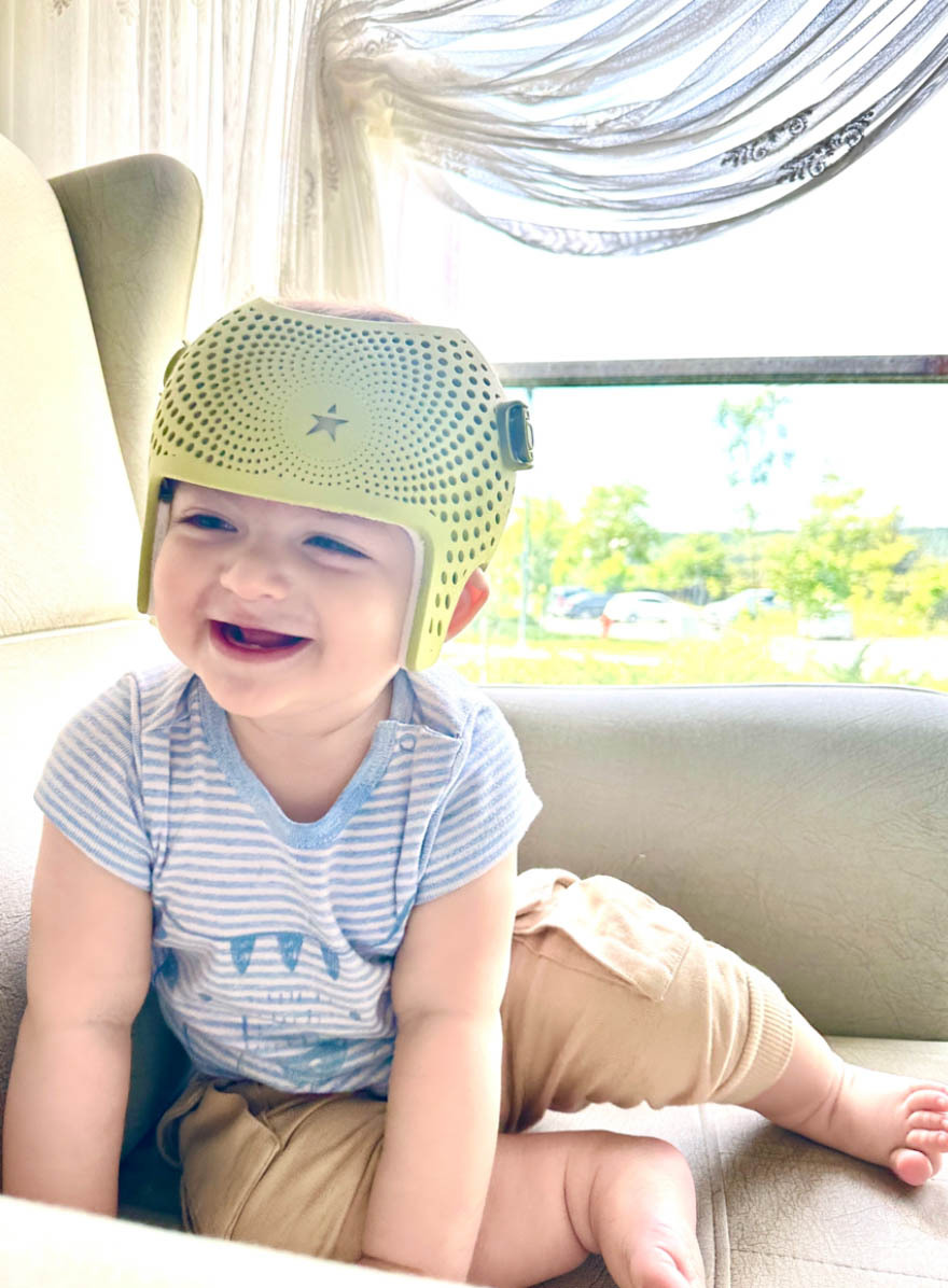 كيف تعمل خوذة علاج قِصر الرأس؟